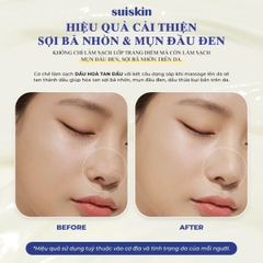 Sáp Tẩy Trang Suiskin Sạch Sâu Loại Bỏ Bã Nhờn Bụi Bẩn Hiệu Qủa Blooming Canola Cleansing Balm Hàn Quốc Hũ 90ml