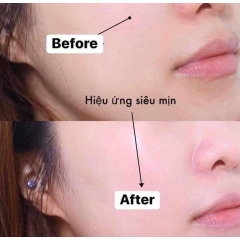 Kem Chống Nắng Ecosy Nâng Tông Mềm Mịn Da Mild Daily Sun Block/ Ultra Daily Sun Cream
