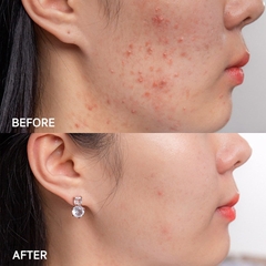 Kem Dưỡng Some By Mi AHA BHA PHA 30 Days Miracle Cream Hũ 60g