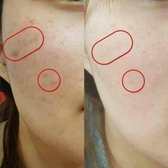 Kem Mờ Nám Kobayashi Keshimin Whitening Cream - DÒNG THƯỜNG 30g
