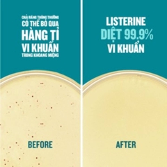 Nước Súc Miệng Listerine Cool Mint Hơi Thở Thơm Mát Ngăn Sâu Răng Viêm Nướu Hương Bạc Hà 750ml