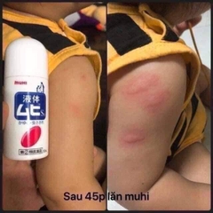 Lăn Muhi Thoa Giảm Sưng Ngứa Do Muỗi Đốt Côn Trùng Cắn Nhật Bản
