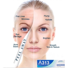 Kem Dưỡng A313 Giảm Mụn Chống Lão Hóa Retinol Cream Pháp 50g