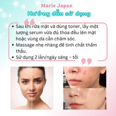 Serum Floslek Giảm Mụn Kiền Dầu Se Lỗ Chân Lông Anti Acne Soothing Tuýp 50ml
