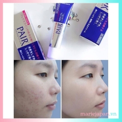 Kem Mụn Pair Giảm Mụn Sưng Viêm Mờ Thâm Nhật Bản
