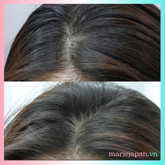 Tinh Chất Mọc Tóc Sato Nhật Bản Chai 30ml Tặng Kèm Chai Xịt