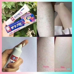 Kem Viêm Nang Lông Rohto Zaraporo Hộp 35g