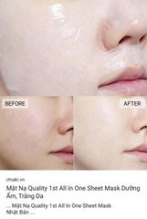 Mặt Nạ QUALITY 1st Túi 5 Miếng Nhật Bản