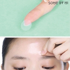 Miếng Dán Mụn Some By Mi Acnes Clear Spot Patch - 18 miếng