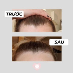 Set Gội Xả HairBurst For Longer  Stronger Hair Travel Size 60ml/chai (Tặng túi Pouch hãng)