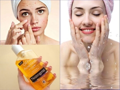 Sữa Rửa Mặt Neutrogena Oil Free Làm Sạch Sâu Kiểm Soát Bã Nhờn Acne Wash USA