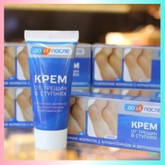 Kem Nẻ Gót Chân Kpem Nga Tuýp 50ml