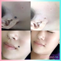 Gel Tẩy Nốt Ruồi Dvelinil Nga Xóa Sạch Mụn Cóc Mụn Thịt DVELINIL 3ML