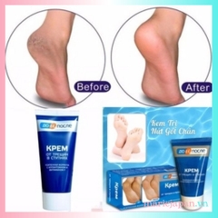 Kem Nẻ Gót Chân Kpem Nga Tuýp 50ml