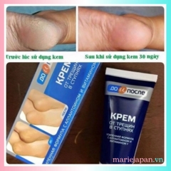 Kem Nẻ Gót Chân Kpem Nga Tuýp 50ml