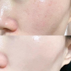 Nước Hoa Hồng NMN Tế Bào Gốc White Skin Lotion Dưỡng Ẩm Sáng Da Chống Lão Hóa Nhật Bản - Chai 500ml