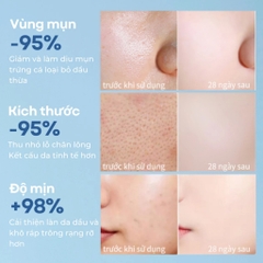 Nước Tẩy Trang Compliment Sạch Sâu Dịu Nhẹ Phù Hợp Mọi Loại Da Micellar Water 400ml