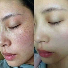 Viên Uống Trắng Da Transamin Hộp 10 Vỉ