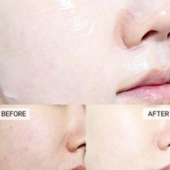 Mặt Nạ Mediheal Dermaplus Cấp Ẩm Dưỡng Sáng Phục Hồi Da Mask Hàn Quốc