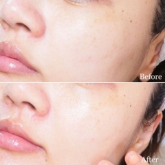 Kem Dưỡng Da Olay Luminous Dưỡng Trắng Mờ Thâm Nám Sáng Khỏe Thái Lan Hộp 50g
