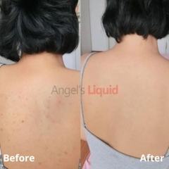 Xịt Body Giảm Mụn Lưng Angel's Liquid Glutathione+ Spot Care Body Mist Sáng Da Giảm Thâm 150ml