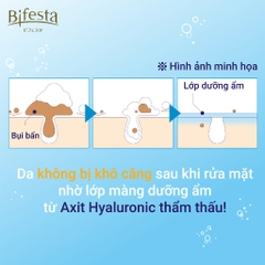 Sữa Rửa Mặt Bifesta Da Dầu Mụn ACNE CARE Tạo Bọt Sạch Sâu Foaming Whip Nhật Bản 180g