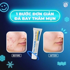 Gel Giảm Mụn Actidem Derma Tuýp 18g