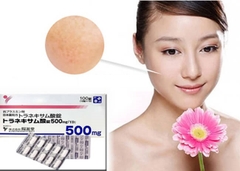Viên uống trắng da trị nám Transamin 500mg Nhật Bản - 100v