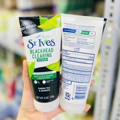 Sữa Rửa Mặt St.Ives 170g