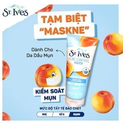 Sữa Rửa Mặt St.Ives 170g