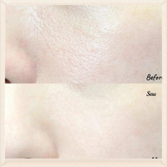 Serum Dưỡng Mềm Da, Giảm Sưng, Ngăn Ngừa Mụn The Ordinary Niacinamide 10% + Zinc 1% 30ml