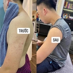 [TL]Kem Kela Lotion Đặc Trị Viêm Da, Viêm Nang Lông 30ml