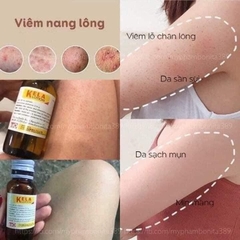 [TL]Kem Kela Lotion Đặc Trị Viêm Da, Viêm Nang Lông 30ml