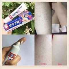 Kem Trị Mụn, Viêm Nang Chân Lông Zaraporo Rohto  35g