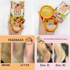 14.10 Kem trị thâm nách Total White Underarm Cream 88 35g