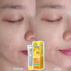 Tinh Chất Dưỡng Trắng Da Chống Thâm Nám Melano CC Whitening Essence 20ml