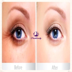 Serum Dưỡng Vùng Da Mắt Balance Active Formula Gold Collagen Rejuvenating eye 15ml (Date T5/2025)