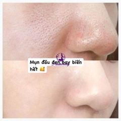 Lăn Mụn Sạch Da Mamonde Pore Clean Blackhead Stick 18g G