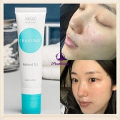 Kem Dưỡng Da Trẻ Hóa, Ngừa Mụn Obagi 360 Retinol 0.5