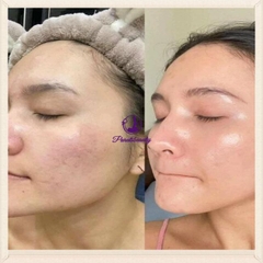 Kem Dưỡng Da Trẻ Hóa, Ngừa Mụn Obagi 360 Retinol 0.5