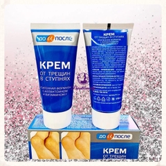 [Nga]Kem Giảm, Ngăn Ngừa Nứt Gót Chân Kpem Apteka Chính Hãng 50ml