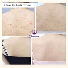 Xà phòng tắm giảm m.ụ.n lưng For Back Nhật Bản