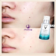 Serum Khoáng Phục Hồi Chuyên Sâu  Thần Thánh Vichy Mineral 89 Pháp 50ml