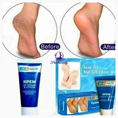 [Nga]Kem Giảm, Ngăn Ngừa Nứt Gót Chân Kpem Apteka Chính Hãng 50ml