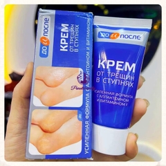 [Nga]Kem Giảm, Ngăn Ngừa Nứt Gót Chân Kpem Apteka Chính Hãng 50ml