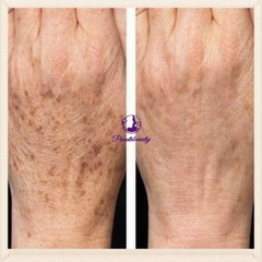 14.10 Kem Trị Nứt Nẻ Gót Chân, Ngón Tay Shishedo Urea 10% Cream Nhật Bản