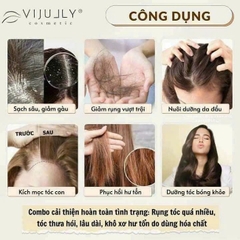 Xịt Tinh Dầu Bưởi  Vijully Hair Lotion 100ml