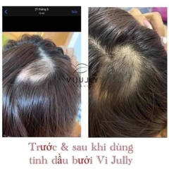 Xịt Tinh Dầu Bưởi  Vijully Hair Lotion 100ml