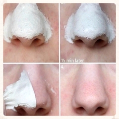 14.11 Kem Lột Mụn Gamma Queen Pelling Pack 50gr