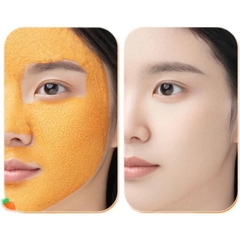 Mặt Nạ Yanfu Tạo Bọt Chiết Xuất Cà Rốt Giảm Mụn Chính Hãng Nội Địa Trung